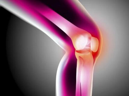 Deformation of arthrosis