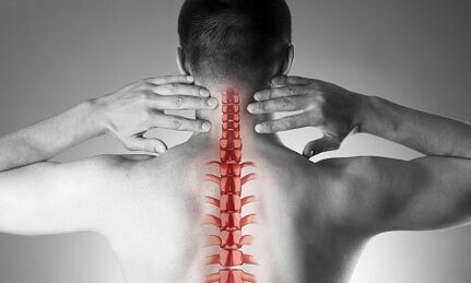 As the osteochondrose of the spine of cervix manifests