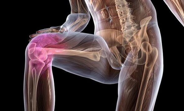 Signs and symptoms of the knee joint arthrosis